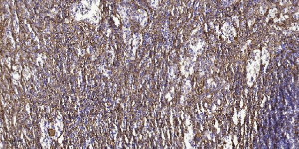 Immunohistochemical analysis of paraffin-embedded human spleen tissue