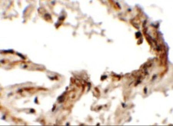 Immunohistochemistry of EMX2 in human lung tissue with EMX2 antibody at 2