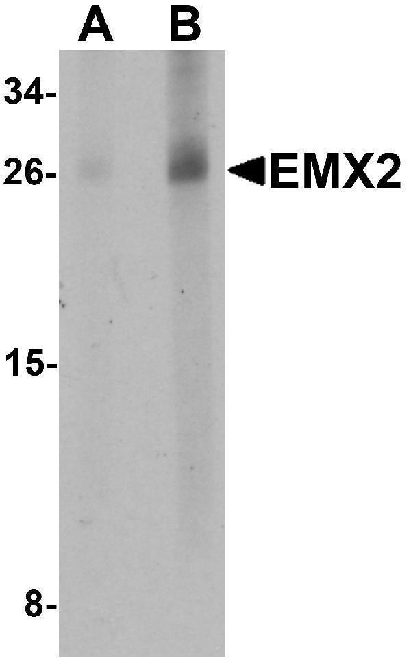 Western blot analysis of EMX2 in human lung tissue lysate with EMX2 antibody at (A) 1 and (B) 2 μg/mL