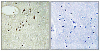 Immunohistochemistry validation of EMX2 using Anti-Homeobox protein EMX2 Emx2 Antibody (A04322-2)