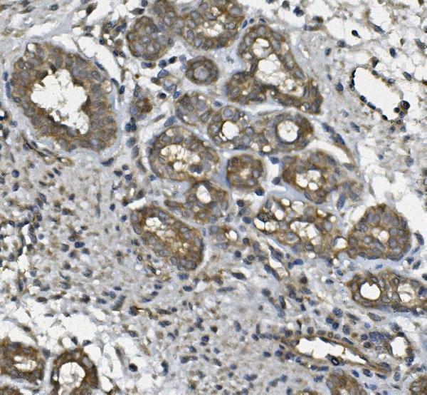 a04323 1 ulbp1 primary antibodies ihc testing 2