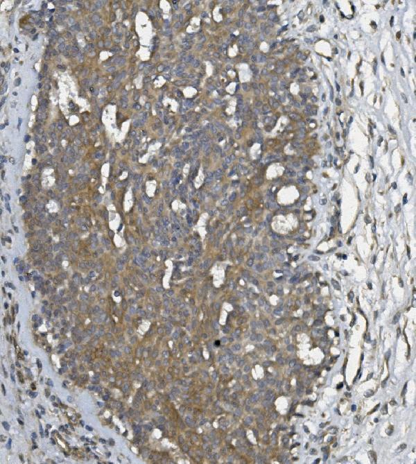 a04323 1 ulbp1 primary antibodies ihc testing 3