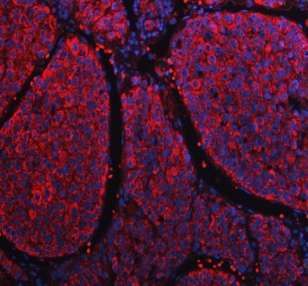 a04326 1 pccb primary antibodies if testing 1