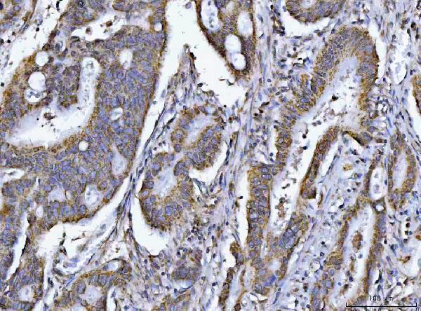  IHC analysis of PCCB using anti-PCCB antibody (A04326-1)