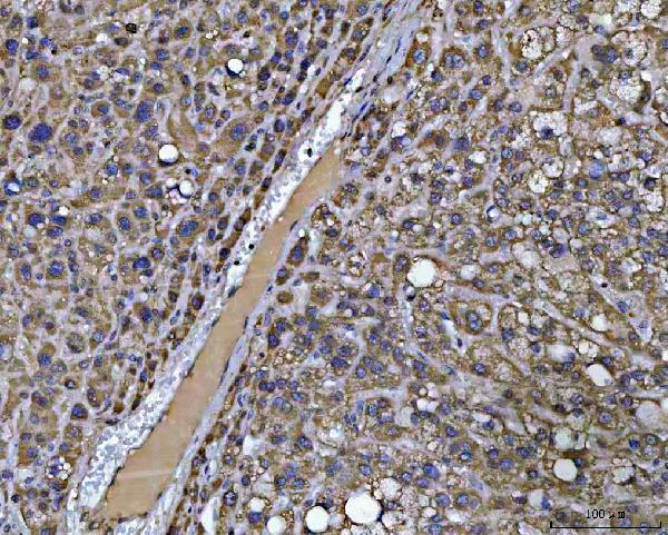  IHC analysis of PCCB using anti-PCCB antibody (A04326-1)