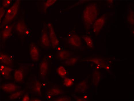 a04326 pccb primary antiboties if testing 3