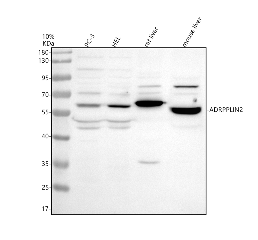Western blot analysis of ADRP using anti-ADRP antibody (A04328-1)