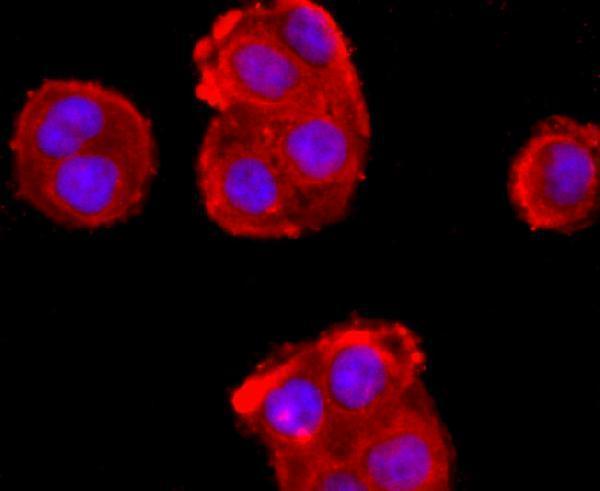 ICC staining ADFP in Hela cells (red)