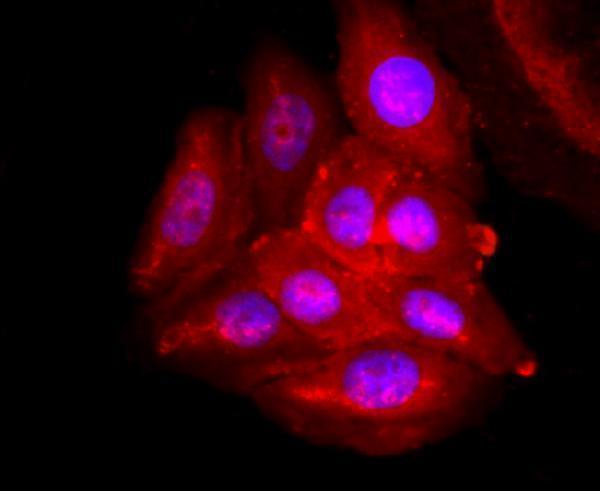 ICC staining ADFP in HepG2 cells (red)