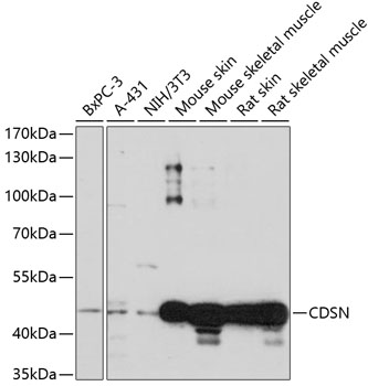 Western blot analysis of extracts of various cell lines, using CDSN antibody  at 1:1000 dilution