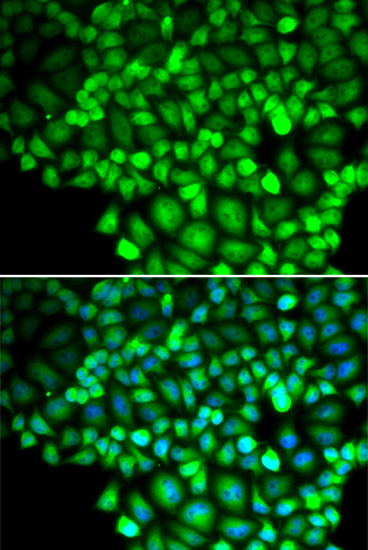 a04331 alox15b primary antiboties if testing 2