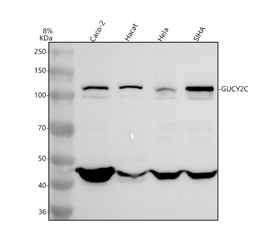 Western blot analysis of GUCY2C using anti-GUCY2C antibody (A04332)