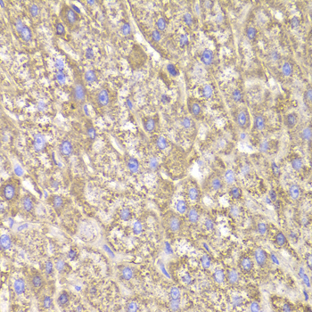 Immunohistochemistry of paraffin-embedded human liver injury using CIAPIN1 Antibody