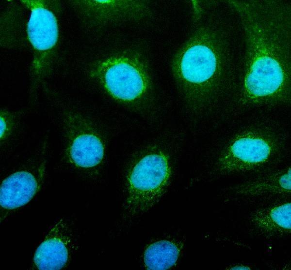 IF analysis of UBE4B using anti-UBE4B antibody (A04338-1)