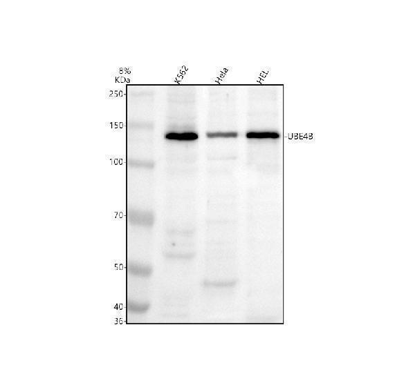 Western blot analysis of UBE4B using anti-UBE4B antibody (A04338-1)