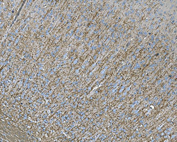  IHC analysis of RAB13 using anti-RAB13 antibody (A04339)