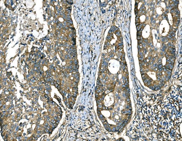 a04339 rab13 primary antibodies ihc testing 3_1