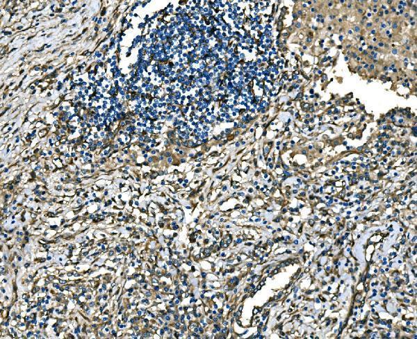 a04339 rab13 primary antibodies ihc testing 5_1