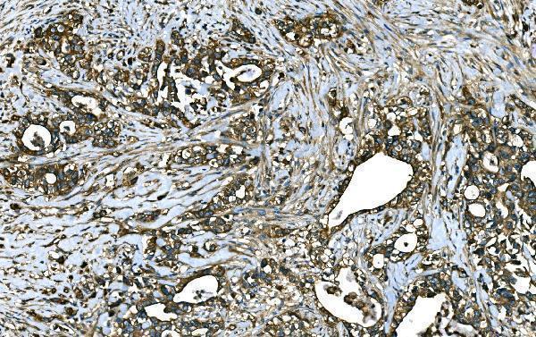 a04339 rab13 primary antibodies ihc testing 7