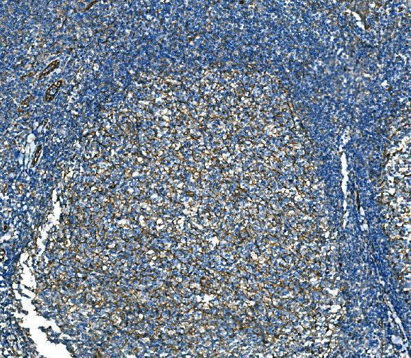 a04339 rab13 primary antibodies ihc testing 8