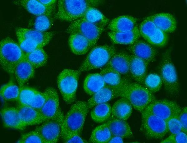 a04341 1 gfpt1 primary antibodies if testing 8
