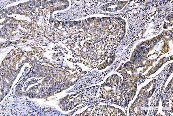  IHC analysis of GFPT1 using anti-GFPT1 antibody (A04341-1)