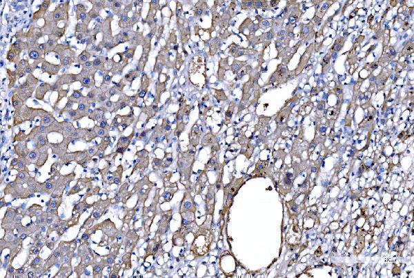  IHC analysis of GFPT1 using anti-GFPT1 antibody (A04341-1)