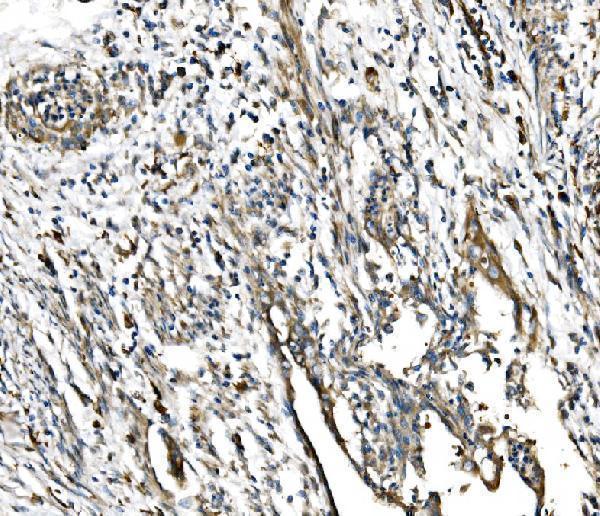 a04341 1 gfpt1 primary antibodies ihc testing 4