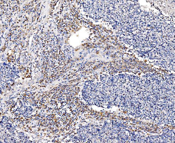 a04341 1 gfpt1 primary antibodies ihc testing 5
