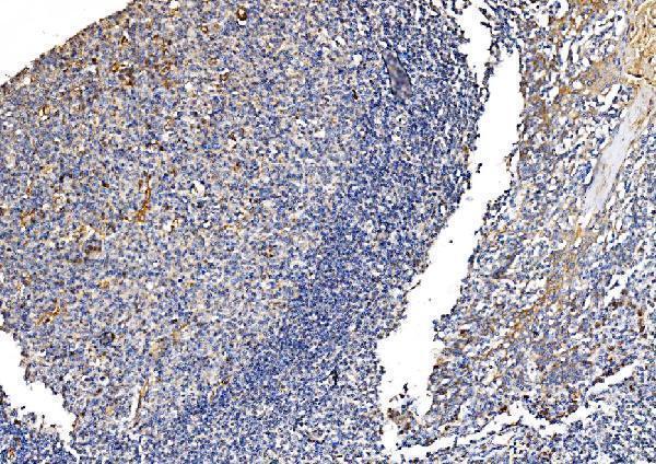 a04341 1 gfpt1 primary antibodies ihc testing 6