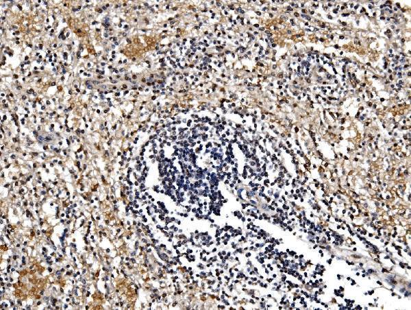 a04341 1 gfpt1 primary antibodies ihc testing 7