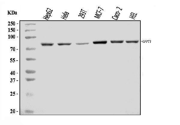 Western blot analysis of GFPT1 using anti-GFPT1 antibody (A04341-1)