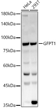 Western blot analysis of various lysates, using GFPT1 antibody  at  1:1510 dilution