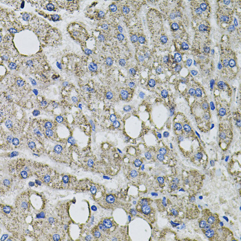 Western blot analysis of Rat lung, using GFPT1 antibody  at  1:1510 dilution