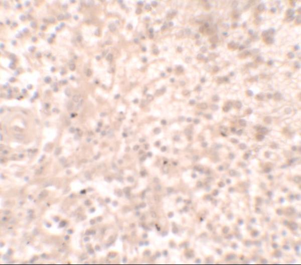 a04342 tlx1 primary antibodies ihc testing 2
