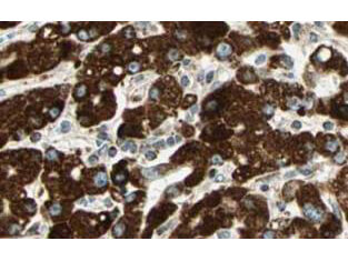 a04343 spry4 primary antibodies ihc testing 3