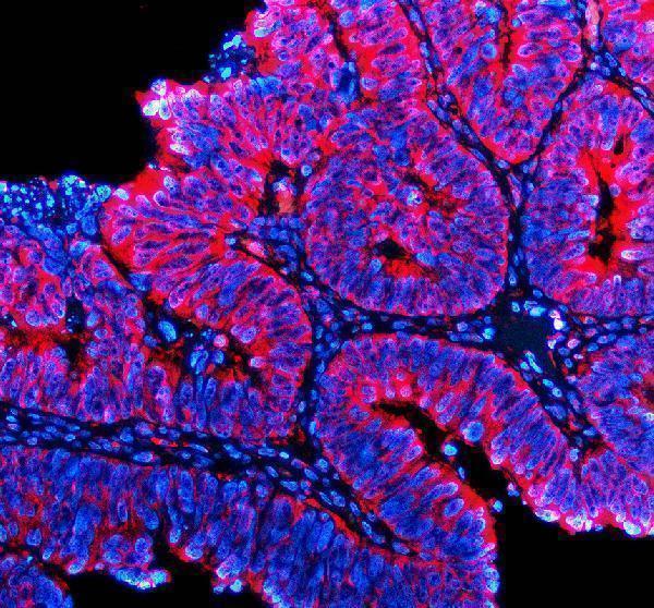 a04344 2 ttf2 primary antibodies if testing 1