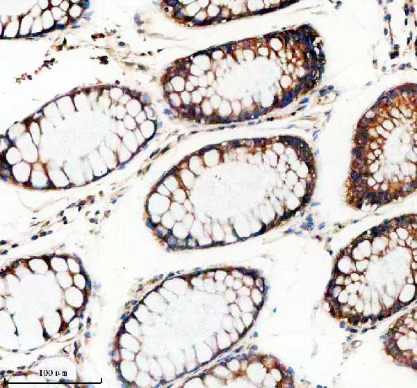 IHC analysis of TTF2 using anti-TTF2 antibody (A04344-2)