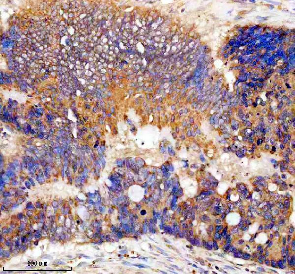 IHC analysis of TTF2 using anti-TTF2 antibody (A04344-2)