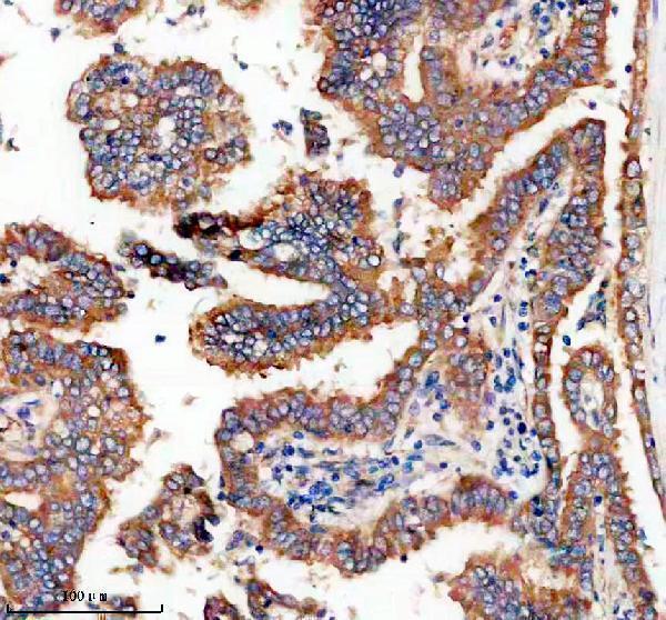 a04344 2 ttf2 primary antibodies ihc testing 3