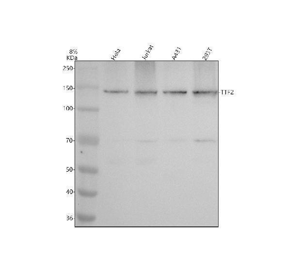 Western blot analysis of TTF2 using anti-TTF2 antibody (A04344-2)