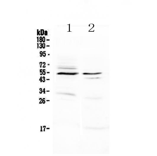a04345 vip_receptor_1 primary antibodies wb testing 1