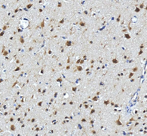 IHC analysis of SEC13 using anti-SEC13 antibody (A04346-1)