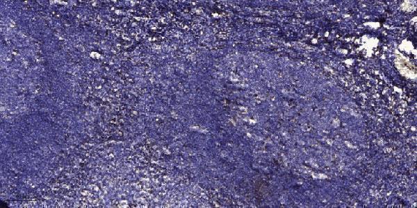 a04347 serpina6 primary antibodies ihc testing 1