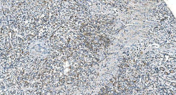 a04348 2 dr6 primary antibodies ihc testing 2