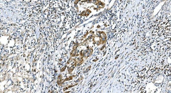 a04348 2 dr6 primary antibodies ihc testing 3