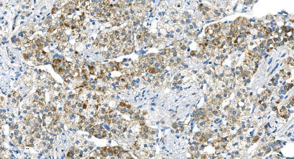 a04348 2 dr6 primary antibodies ihc testing 4