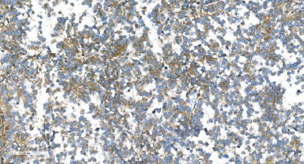 a04348 2 dr6 primary antibodies ihc testing 6