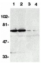 a04348 tnfrsf21 primary antibodies wb testing 1