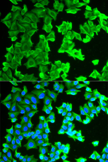 Immunofluorescence analysis of Hela cells, using RPLP0 polyclonal antibody